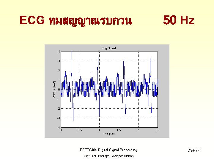 ECG ทมสญญาณรบกวน EEET 0485 Digital Signal Processing Asst. Prof. Peerapol Yuvapoositanon 50 Hz DSP