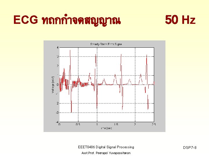 ECG ทถกกำจดสญญาณ EEET 0485 Digital Signal Processing Asst. Prof. Peerapol Yuvapoositanon 50 Hz DSP