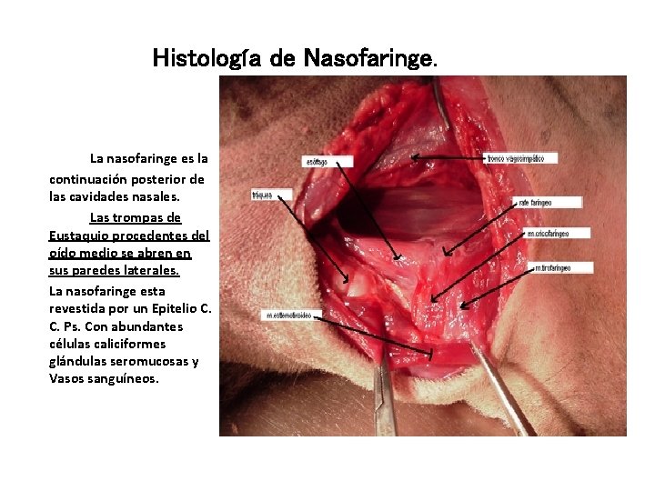 Histología de Nasofaringe. La nasofaringe es la continuación posterior de las cavidades nasales. Las