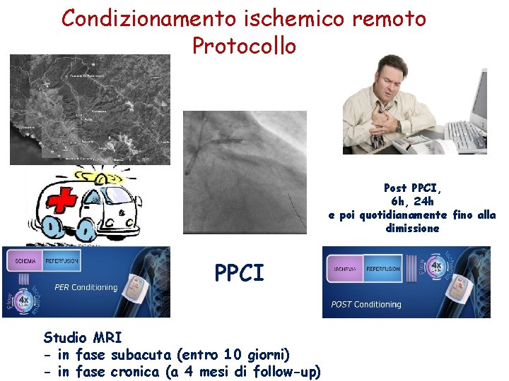 Condizionamento ischemico remoto Protocollo Post PPCI, 6 h, 24 h e poi quotidianamente fino