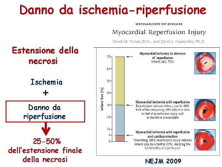 Danno da ischemia-riperfusione Estensione della necrosi Ischemia + Danno da riperfusione 25 -50% dell’estensione