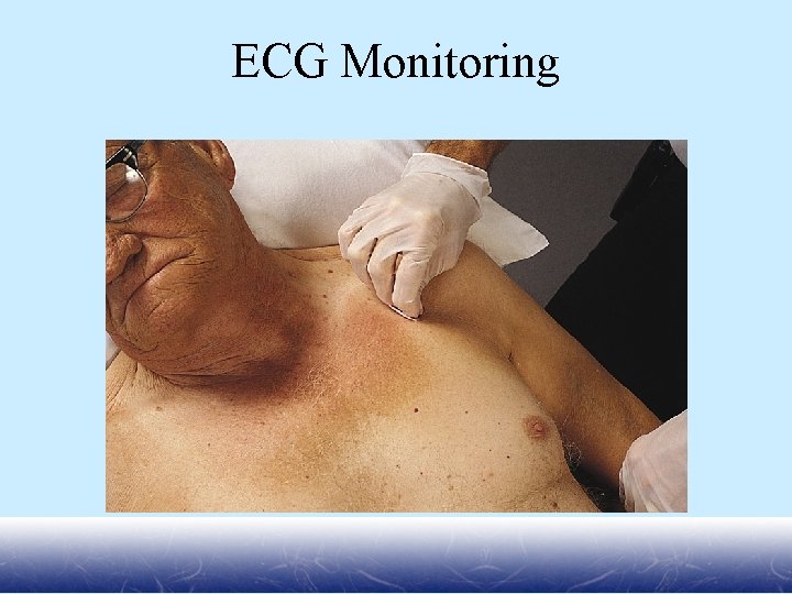 ECG Monitoring 