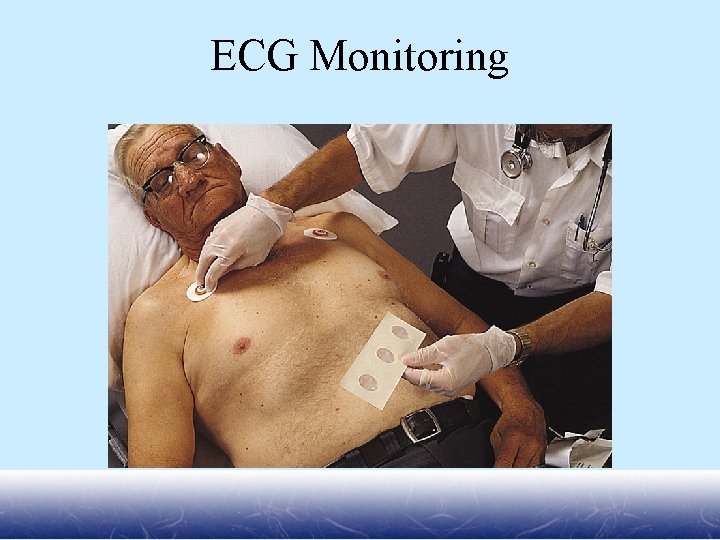 ECG Monitoring 