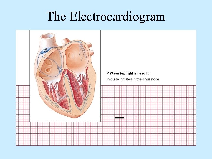 The Electrocardiogram 