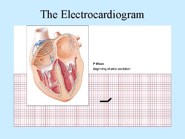 The Electrocardiogram 