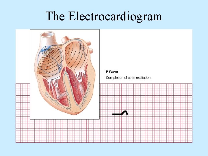 The Electrocardiogram 