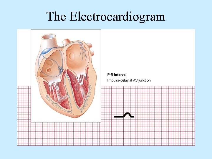 The Electrocardiogram 