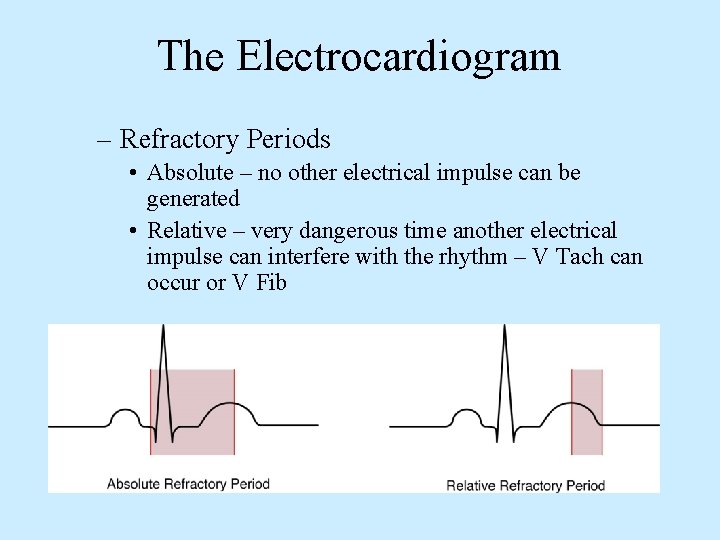 The Electrocardiogram – Refractory Periods • Absolute – no other electrical impulse can be