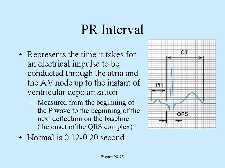 PR Interval • Represents the time it takes for an electrical impulse to be