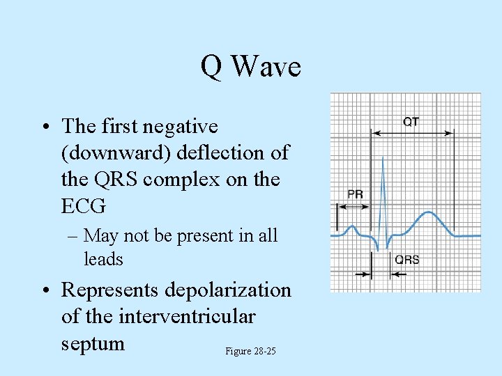 Q Wave • The first negative (downward) deflection of the QRS complex on the