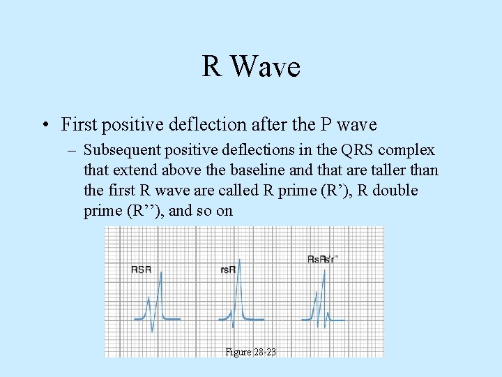 R Wave • First positive deflection after the P wave – Subsequent positive deflections