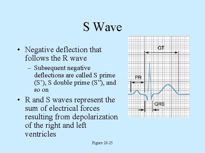 S Wave • Negative deflection that follows the R wave – Subsequent negative deflections