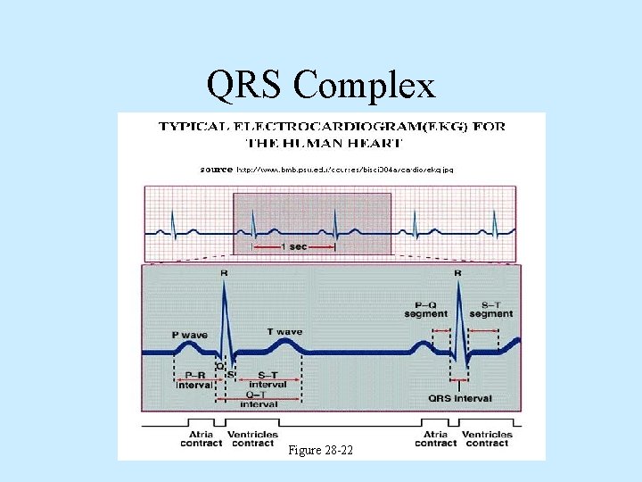 QRS Complex Figure 28 -22 