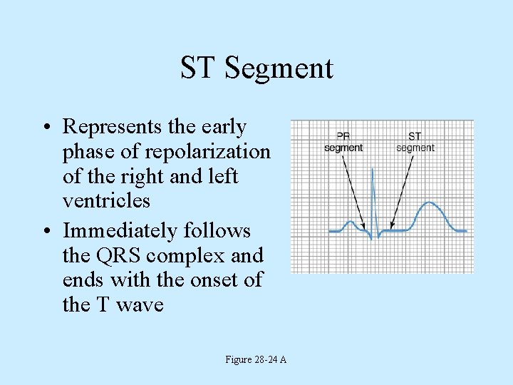 ST Segment • Represents the early phase of repolarization of the right and left