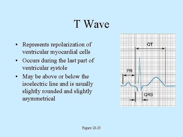 T Wave • Represents repolarization of ventricular myocardial cells • Occurs during the last