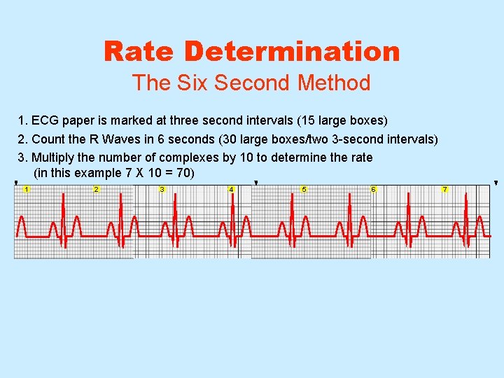 Rate Determination The Six Second Method 1. ECG paper is marked at three second