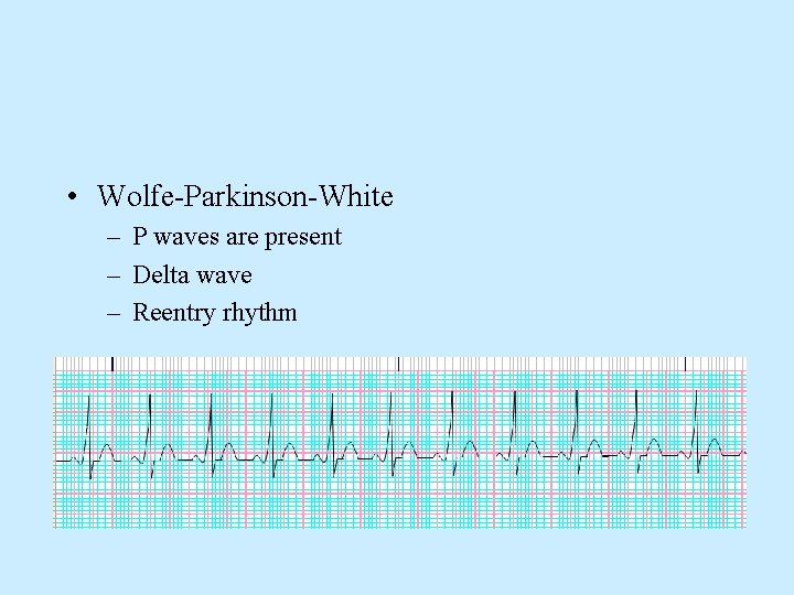  • Wolfe-Parkinson-White – P waves are present – Delta wave – Reentry rhythm