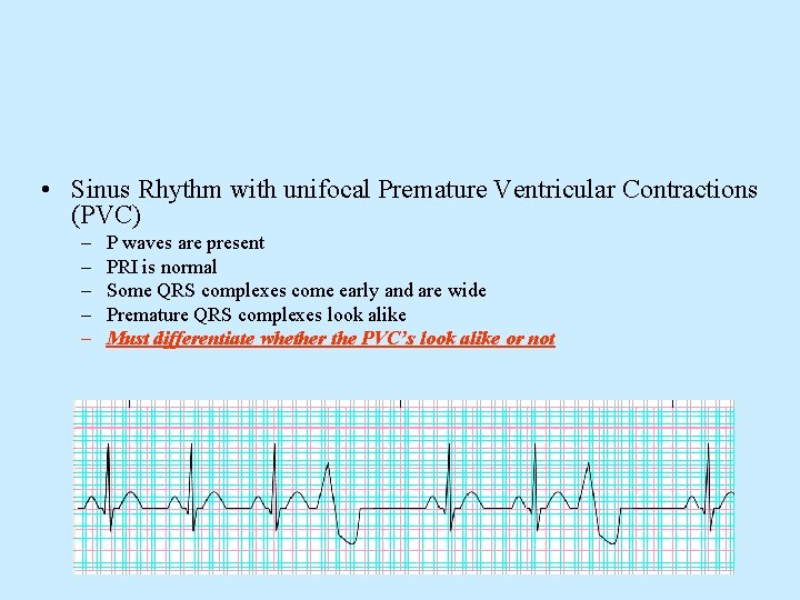 Electrophysiology Of The Heart Ecg Monitoring The Ecg