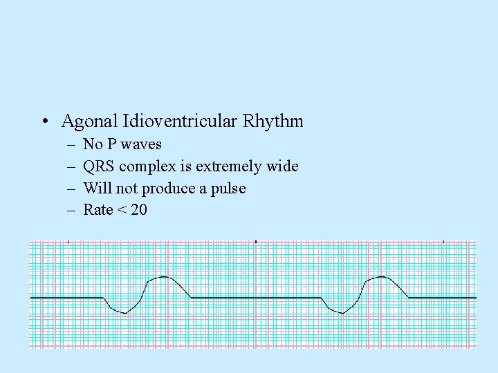  • Agonal Idioventricular Rhythm – – No P waves QRS complex is extremely