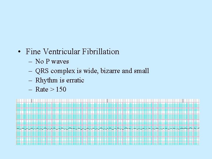  • Fine Ventricular Fibrillation – – No P waves QRS complex is wide,