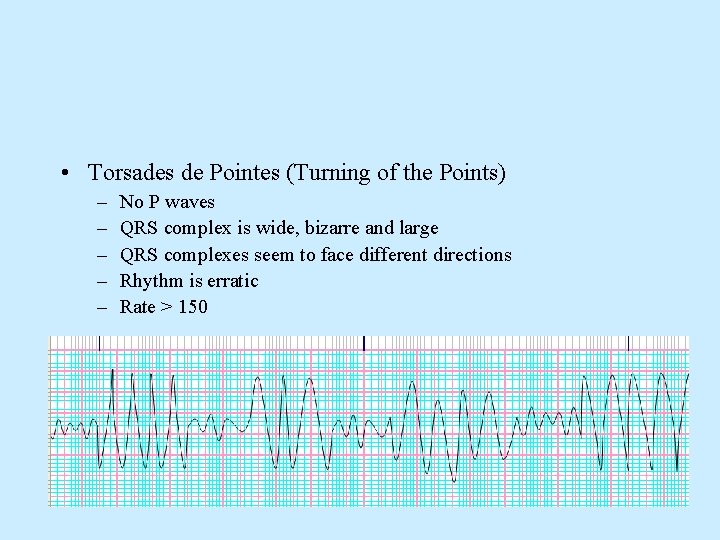  • Torsades de Pointes (Turning of the Points) – – – No P