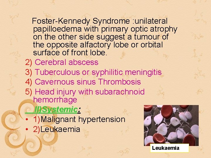 Foster-Kennedy Syndrome : unilateral papilloedema with primary optic atrophy on the other side suggest Foster-Kennedy Syndrome : unilateral papilloedema with primary optic atrophy on the other side suggest
