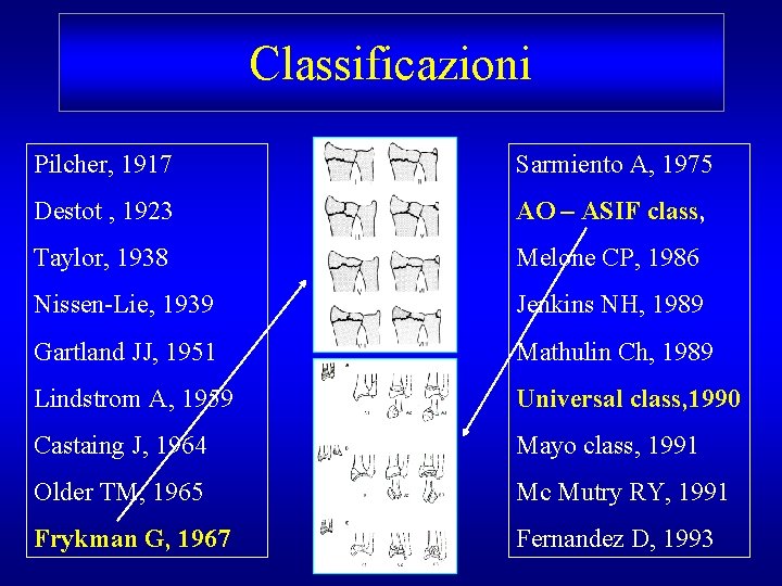 Classificazioni Pilcher, 1917 Sarmiento A, 1975 Destot , 1923 AO – ASIF class, Taylor,