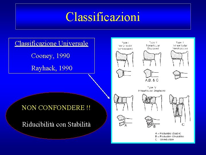 Classificazioni Classificazione Universale Cooney, 1990 Rayhack, 1990 NON CONFONDERE !! Riducibilità con Stabilità 