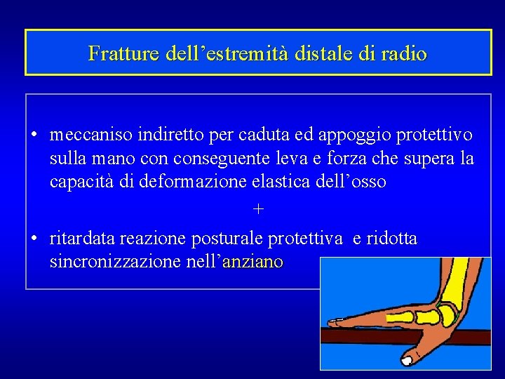 Fratture dell’estremità distale di radio • meccaniso indiretto per caduta ed appoggio protettivo sulla