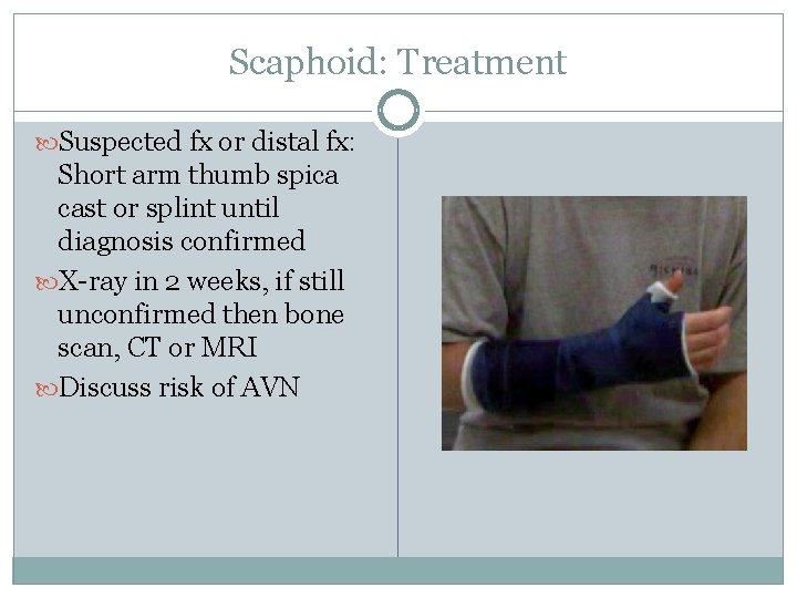 Scaphoid: Treatment Suspected fx or distal fx: Short arm thumb spica cast or splint