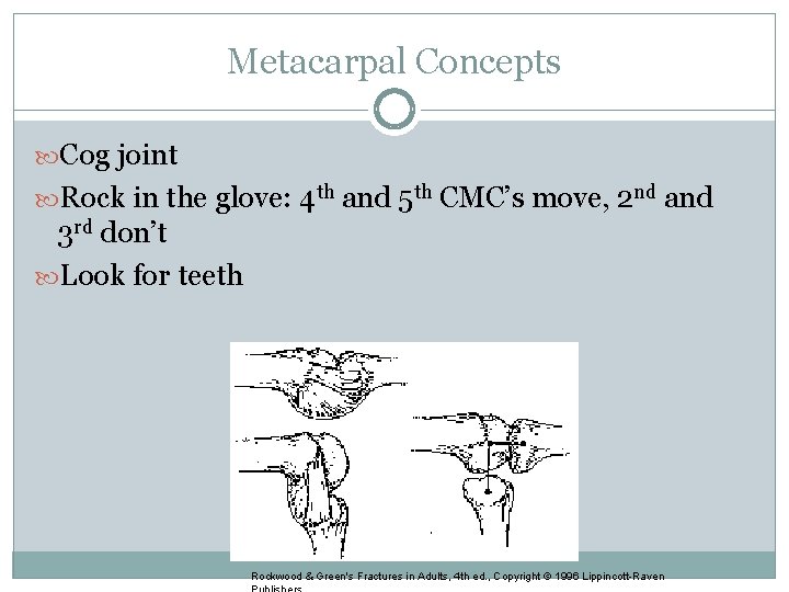 Metacarpal Concepts Cog joint Rock in the glove: 4 th and 5 th CMC’s