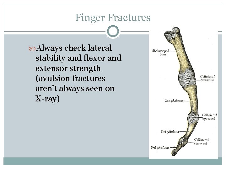 Finger Fractures Always check lateral stability and flexor and extensor strength (avulsion fractures aren’t