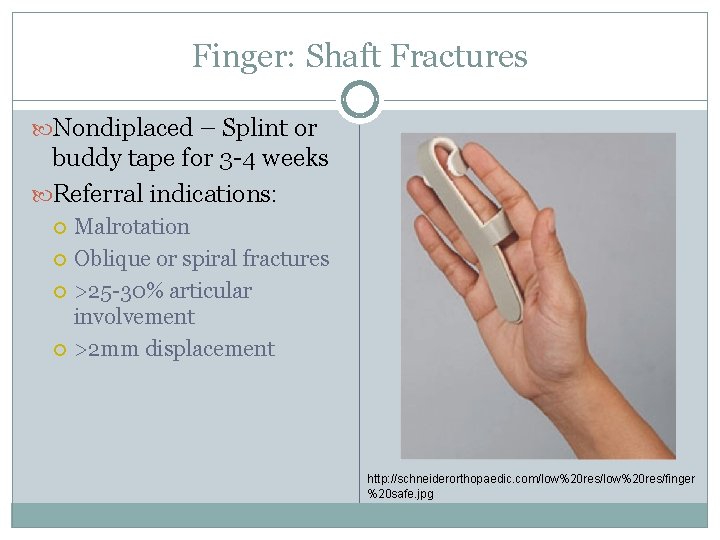 Finger: Shaft Fractures Nondiplaced – Splint or buddy tape for 3 -4 weeks Referral