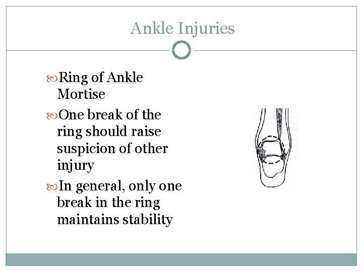 Ankle Injuries Ring of Ankle Mortise One break of the ring should raise suspicion