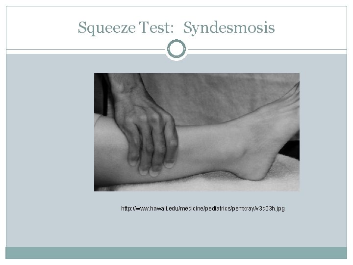 Squeeze Test: Syndesmosis http: //www. hawaii. edu/medicine/pediatrics/pemxray/v 3 c 03 h. jpg 