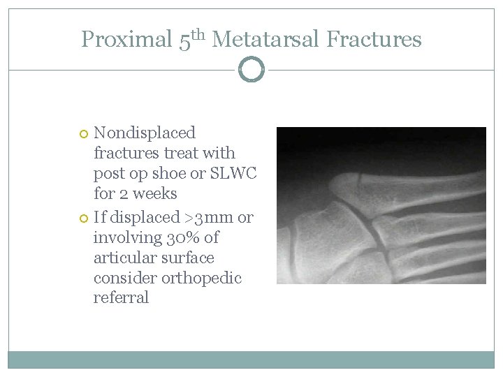 Proximal 5 th Metatarsal Fractures Nondisplaced fractures treat with post op shoe or SLWC