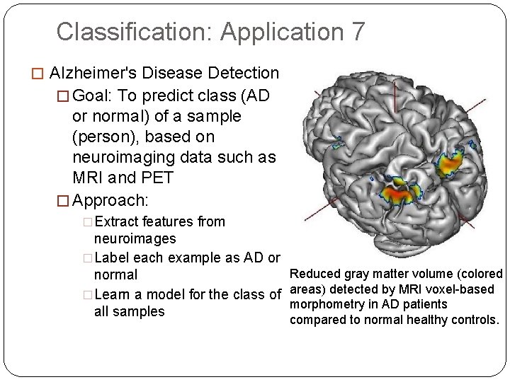 Classification: Application 7 � Alzheimer's Disease Detection � Goal: To predict class (AD or