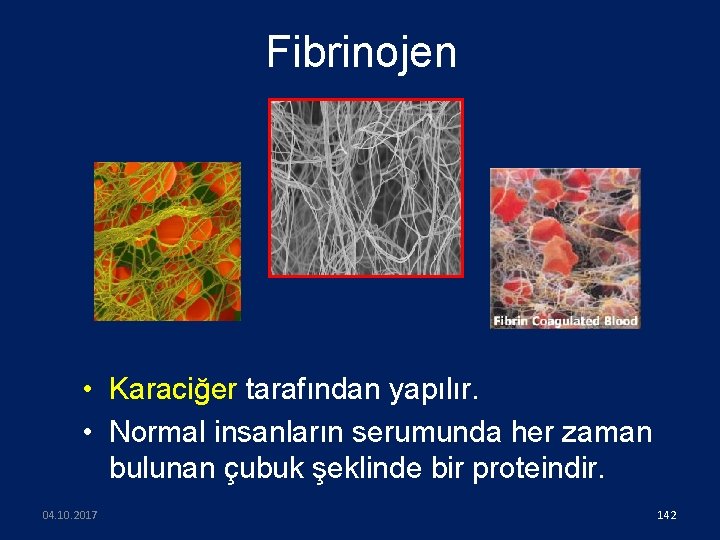 Fibrinojen • Karaciğer tarafından yapılır. • Normal insanların serumunda her zaman bulunan çubuk şeklinde