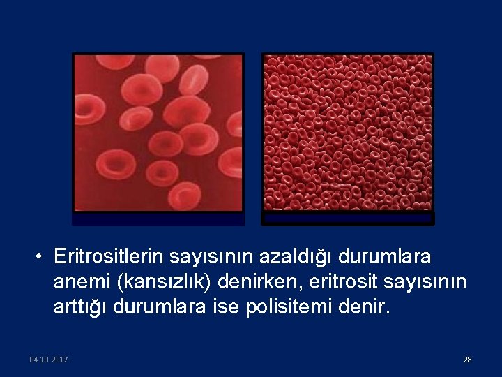  • Eritrositlerin sayısının azaldığı durumlara anemi (kansızlık) denirken, eritrosit sayısının arttığı durumlara ise