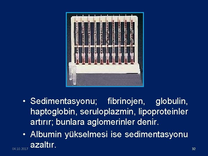  • Sedimentasyonu; fibrinojen, globulin, haptoglobin, seruloplazmin, lipoproteinler artırır; bunlara aglomerinler denir. • Albumin