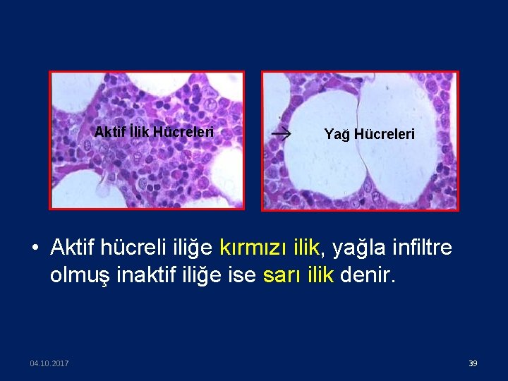 Aktif İlik Hücreleri Yağ Hücreleri • Aktif hücreli iliğe kırmızı ilik, yağla infiltre olmuş