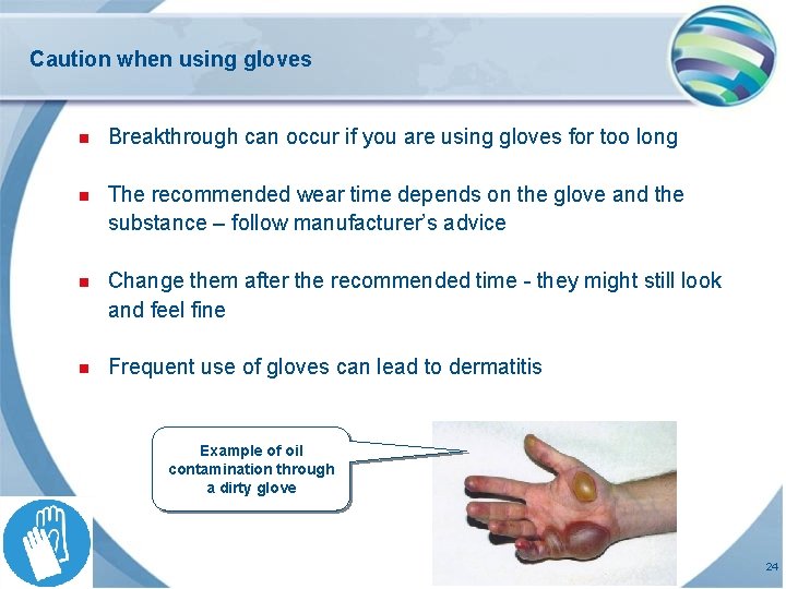 Caution when using gloves n Breakthrough can occur if you are using gloves for