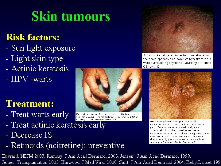 Skin tumours Risk factors: - Sun light exposure - Light skin type - Actinic