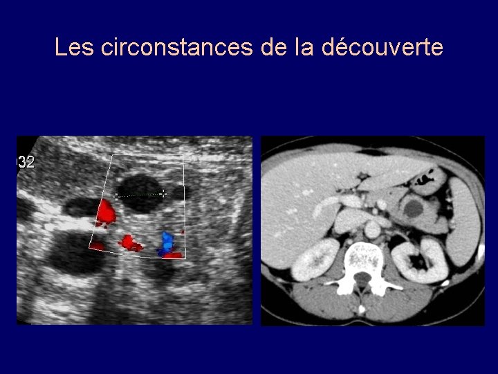 Les circonstances de la découverte 