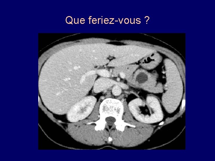 Que feriez-vous ? 