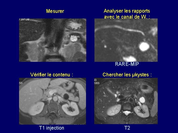 Mesurer Analyser les rapports avec le canal de W. : RARE-MIP Vérifier le contenu