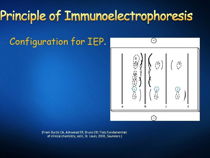 Principle of Immunoelectrophoresis Configuration for IEP. (From Burtis CA, Ashwood ER, Bruns DB: Tietz