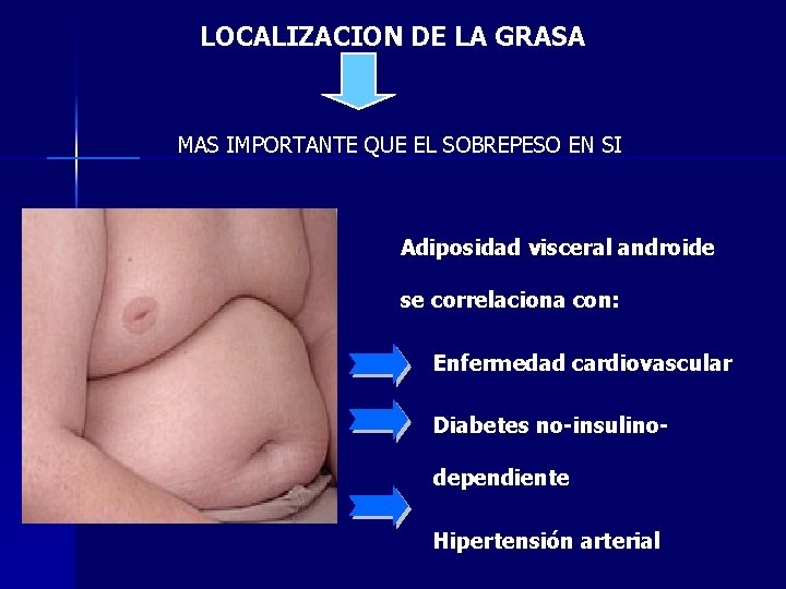 LOCALIZACION DE LA GRASA MAS IMPORTANTE QUE EL SOBREPESO EN SI Adiposidad visceral androide