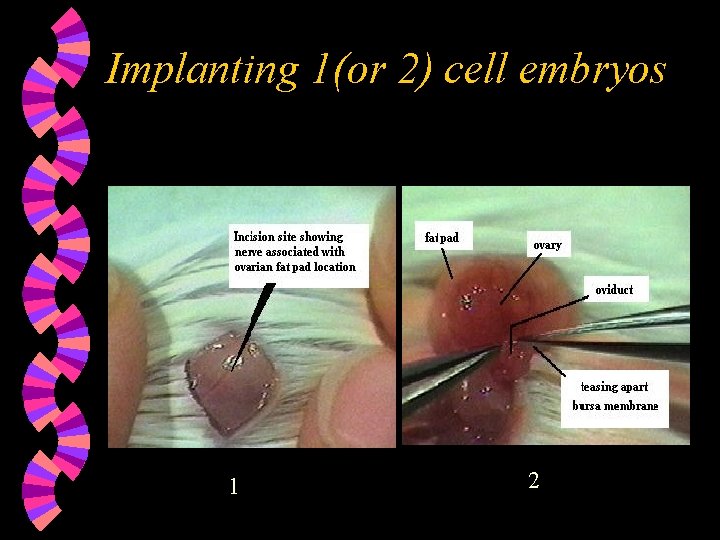Implanting 1(or 2) cell embryos 1 2 