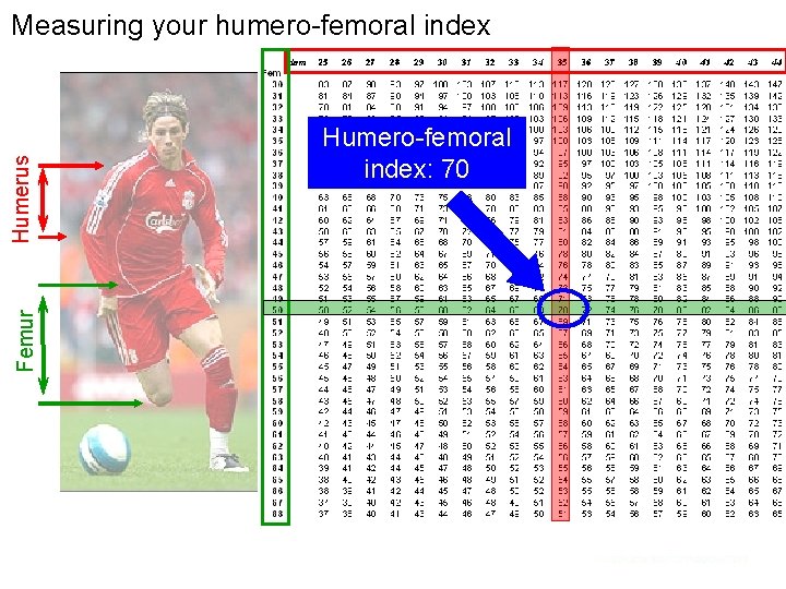 Femur Humerus Measuring your humero-femoral index Humero-femoral index: 70 